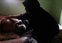 Atizah, Balita Hidrosefalus di Tanggamus Butuh Uluran Tangan